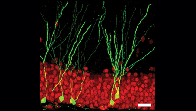 A cellular image shows the presence of new brain cells, labeled with GFP, among older ones.