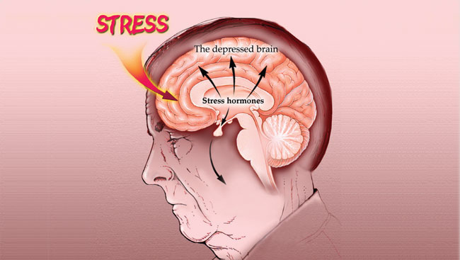 An illustration of brain areas affected by stress