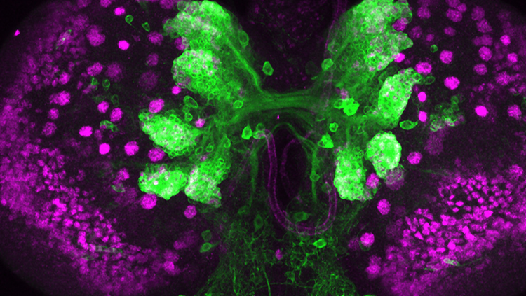 image of two lobes of the brain of a fruit fly larva with hundreds of neurons, colored green, and stem cells, colored magenta