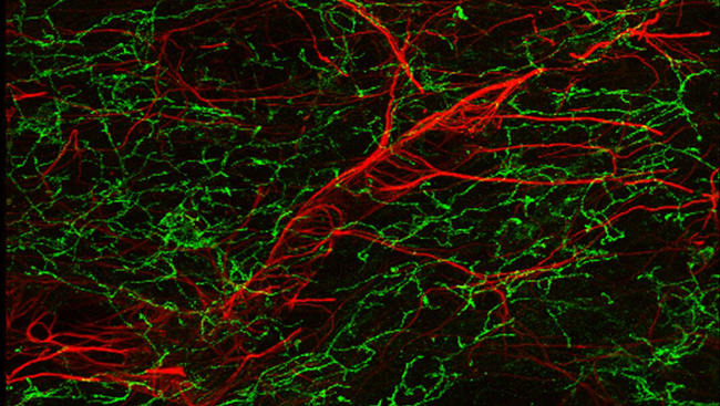 Studies in animals led researchers to new understandings about the molecules the blood-brain barrier welcomes in and those it turns away. This image displays an outline of a blood vessel (red) in the brain of a healthy mouse.