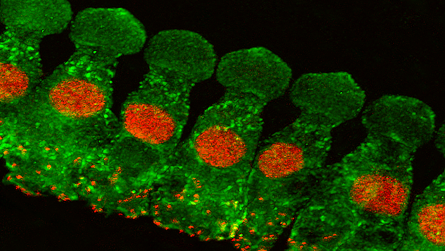Called hair cells (pictured in green), each cell has tiny hair-like projections that vibrate along with the sound waves, triggering a sequence of events inside the cell to generate an electrical signal. Hair cells quickly transmit these signals to brain cells using synaptic ribbons (pictured in red), structures specialized for rapid signaling — important for hearing sound.