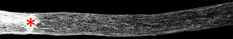 Tissue section of adult mouse optic nerve
