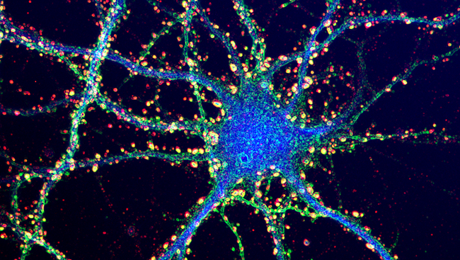 This image shows a neuron from a mouse hippocampus, an area of the brain responsible for memory, with synapses labelled in yellow and red. 