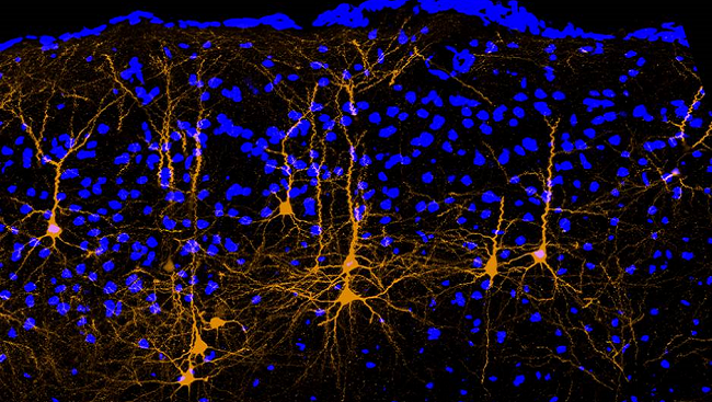 In this picture of a mouse brain, neurons (yellow) from the brain’s movement area (motor cortex) extend their long axons to a portion of the brain responsible for hearing called the auditory cortex. 