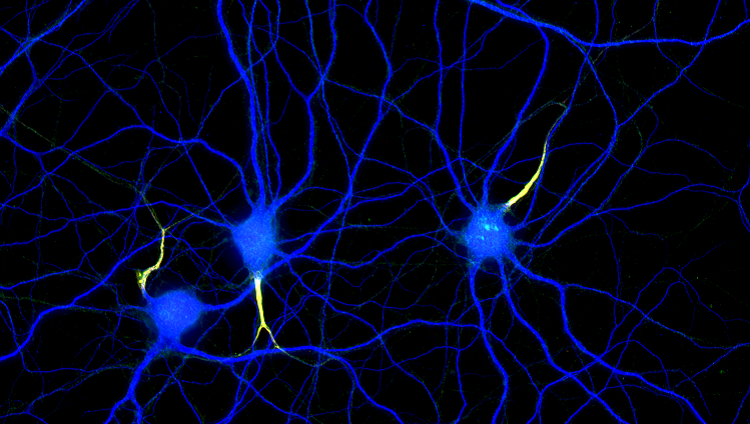 Image of axons and dendrites