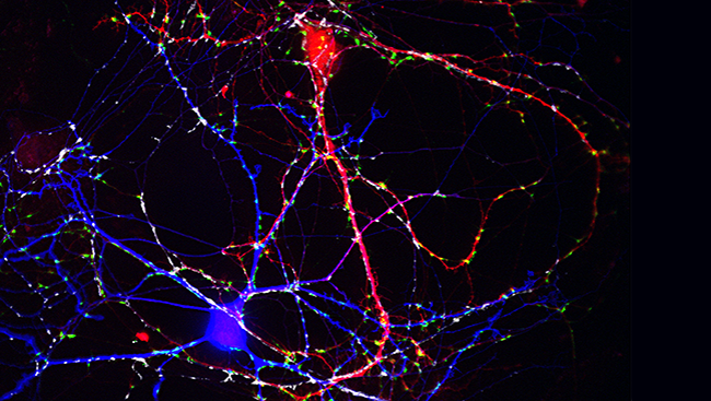 This image of brain neurons cultured from a mouse shows this interaction: the “inhibitory” neuron (blue) sends signals that can prevent the “excitatory” neuron (red) from firing. 