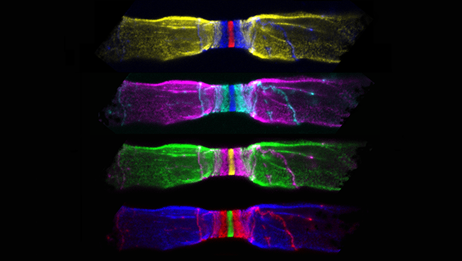 Myelin — a fatty material that wraps around axons (pictured on the left and right of nerve fibers above) — preserves the strength of these signals, allowing them to move quickly along the axon. At each node, or gap in the myelin sheath (center above), electrical signals are amplified, allowing the signal to jump to the next node. 