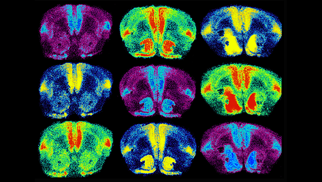 This image shows the brains of monogamous prairie voles, with oxytocin receptors labeled in light blue, red, and yellow. When researchers used genetic techniques to increase oxytocin receptor levels in the brain (right column), they found female voles formed partner preferences faster.