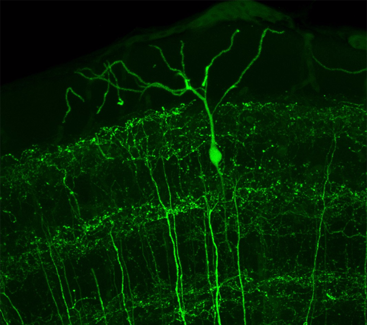 bipolar neurone