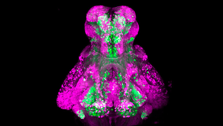 Four-day-old zebrafish brain