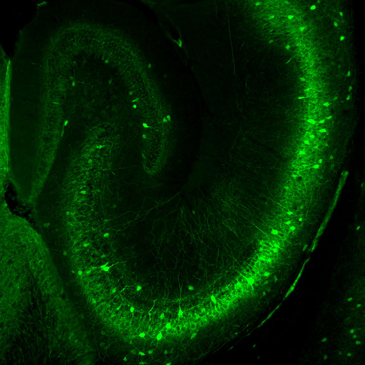  Interneurons of the mouse hippocampus