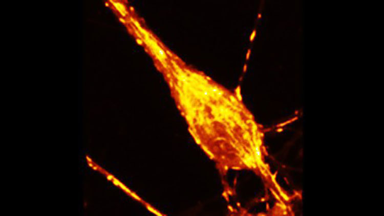 red and yellow calcium neuron black background