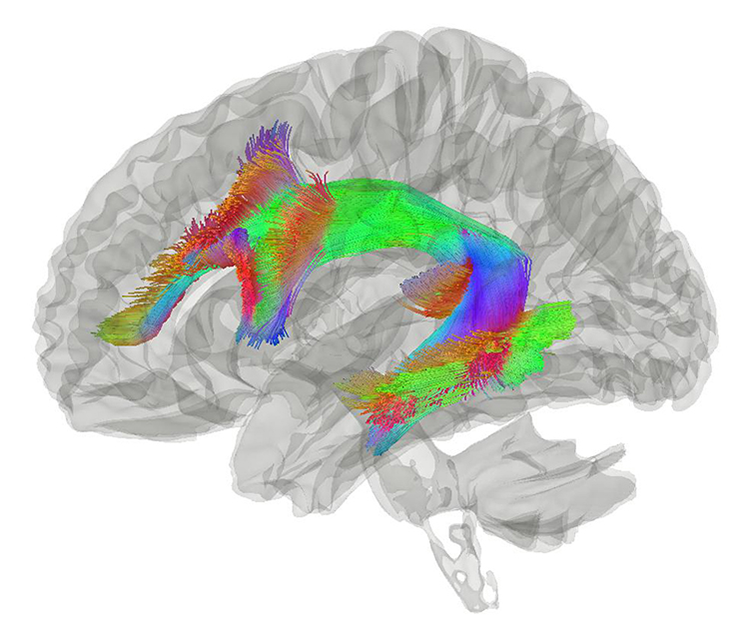 colorful brain