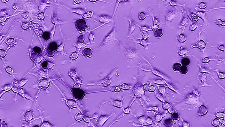Glioblastoma cells 