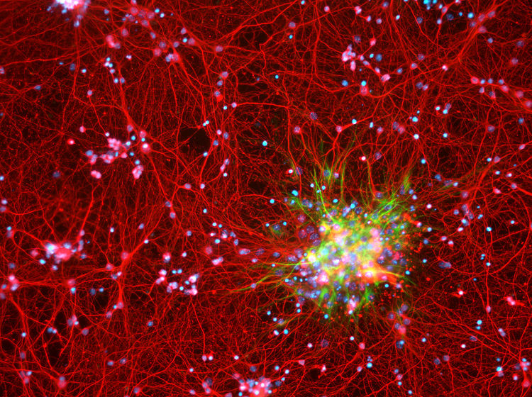 astrocyte red