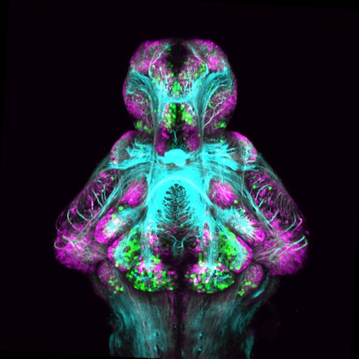 This image shows the expression patterns of three different genes (tagged with blue, green, and magenta dyes) in the brain of a zebrafish.