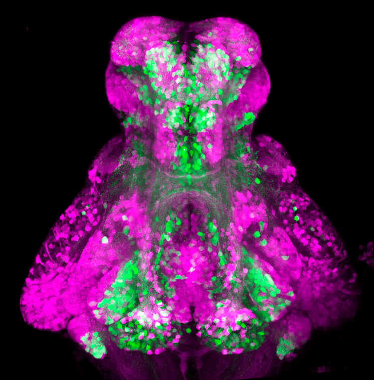 Image of GABAergic and Glutamatergic neurons in the zebrafish brain’