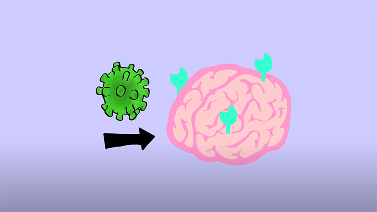 Coronavirus in the brain