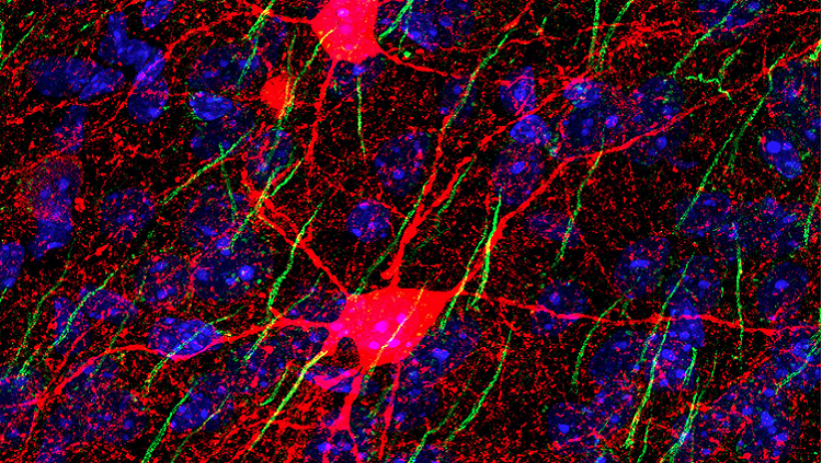 Image of cells in the medial prefrontal cortex 