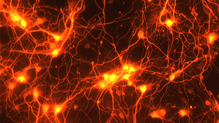 Image of healthy neurons grown in a dish, sprouting new connections