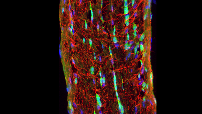 The image shows the optic nerve in a mouse with neuron cell bodies (blue) and support cells called glia (red and green). 