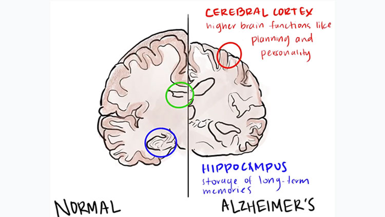 Chart of a brain