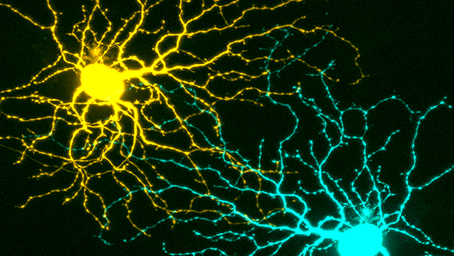 This image shows two healthy retinal ganglion cells in yellow and teal. 