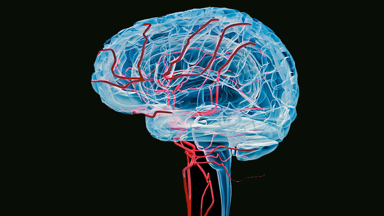 Brain with bloodvessels x-ray (Side) 