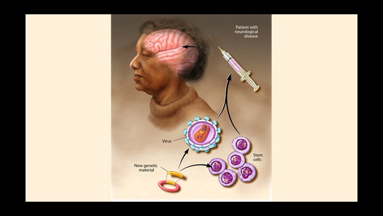 The effects of gene therapy