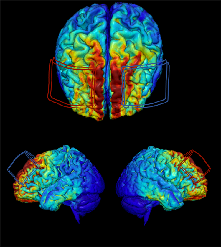  MRI-derived model of brain