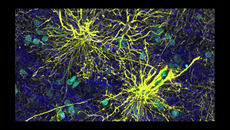 Human temporal lobe cortex immunolabeled for astrocytes (GFAP; yellow), neurons (MAP2; blue), and nuclei (DAPI; green) shows protoplasmic astrocytes and a varicose projection astrocyte, a novel glial type. 