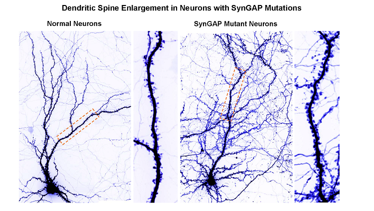 SynGap Mutant Neurons