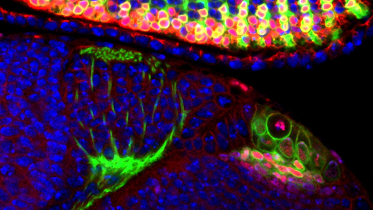 With more than half of its tiny brain devoted to sight, the fruit fly is a favorite animal model for scientists studying the visual system. 