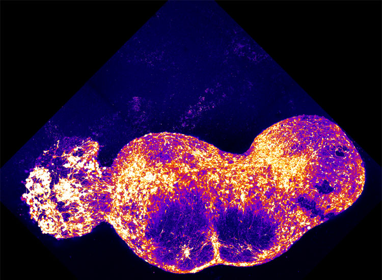 An organoid representing the dorsal root ganglion