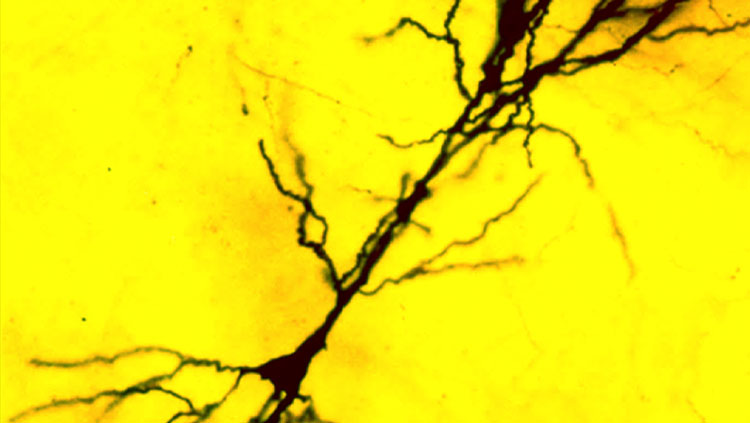 A single CA1 pyramidal cell from hippocampal area