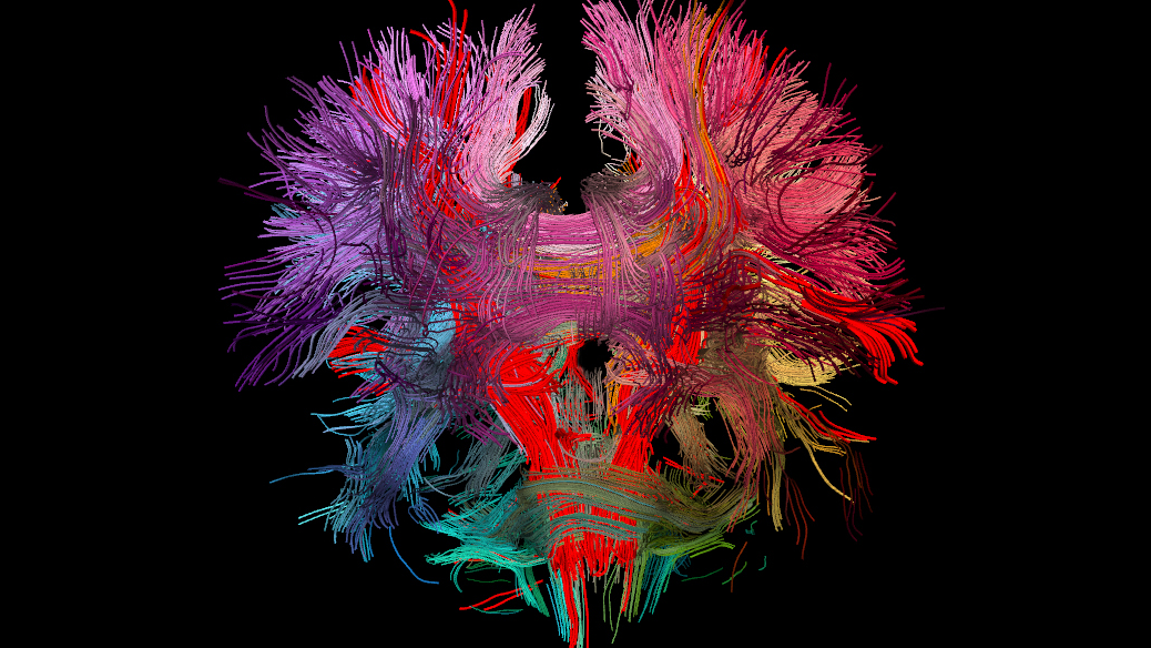 Image of the DTI scan of the human brain.