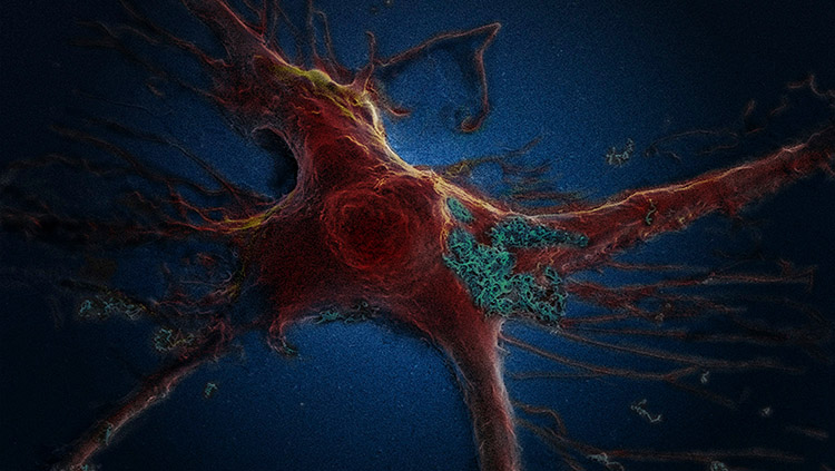 Image of brain astrocyte cell