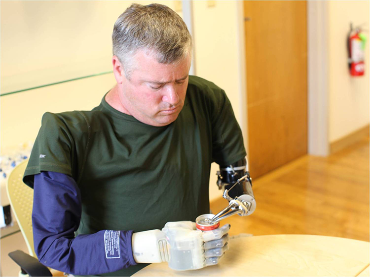 A man with two prosthetic arms opens a can.