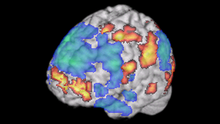 Image of an fMRI