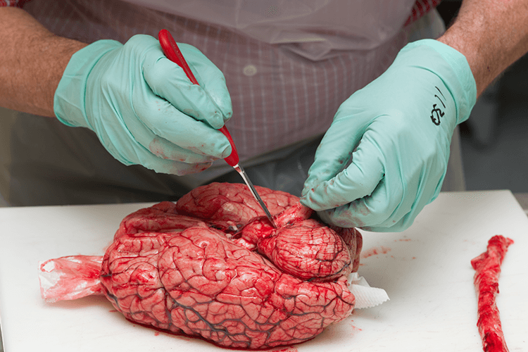 Researcher dissecting a human brain