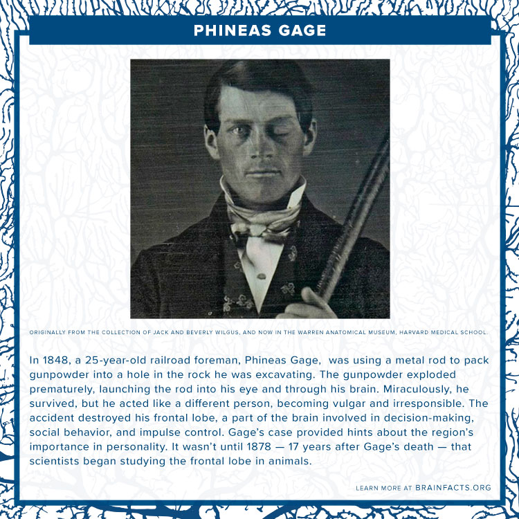 Phineas Gage Brian Byte