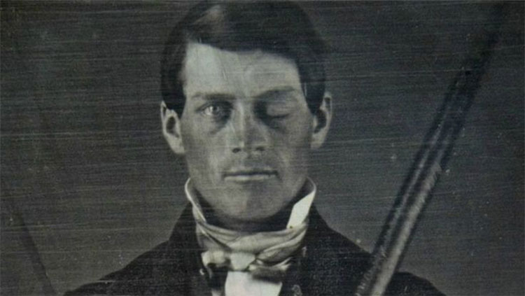 Phineas Gage 