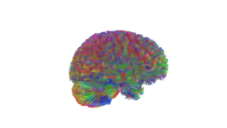 Image of brain using MRI scans