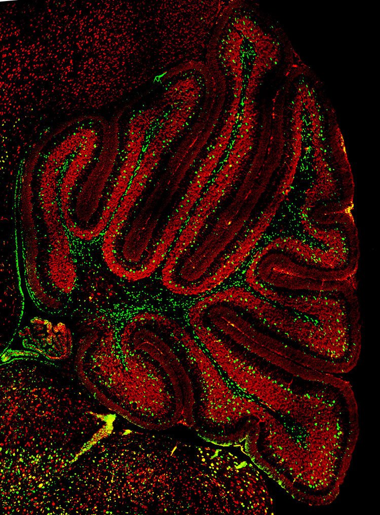 Mouse cerebellum