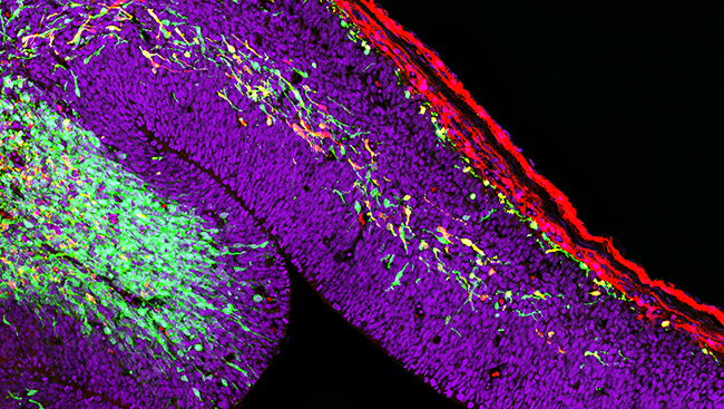 In the image above, interneurons (green and yellow) are travelling to the developing cerebral cortex in a young mouse brain, forming highways of migratory cells.