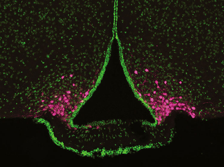 AgRP neurons