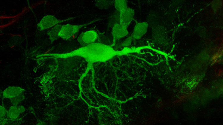 Image of a a reticulospinal neuron in a zebrafish