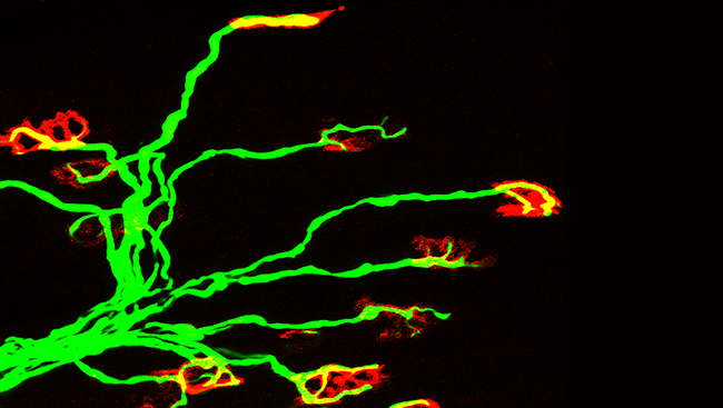 This image shows motor neurons (green) making contact with muscle cells (red) in the neck muscle of a young mouse. 