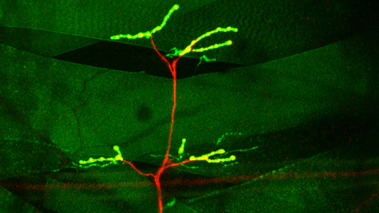 muscle fibers motor neurons red and green