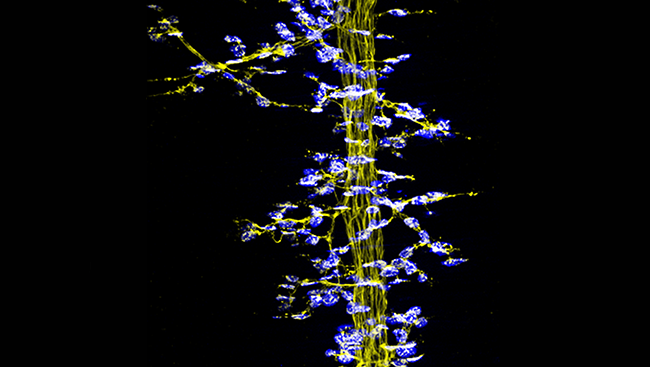 Nerve cells talk to muscles at sites called neuromuscular junctions, as shown in this image from an embryonic mouse. 